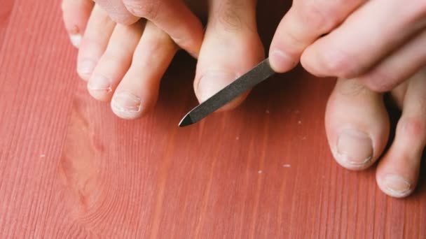 Man is sawing his thumbnail on the leg with a nail file close-up. A man makes himself a pedicure at home on the floor, top view — Stock Video