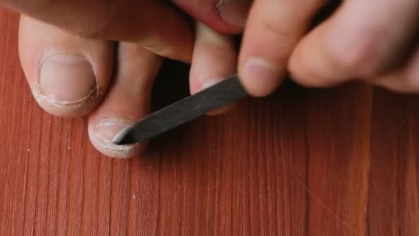 El hombre está pelando sus uñas en la pierna con una lima de uñas de cerca. Un hombre se hace una pedicura en casa en el suelo, vista superior — Vídeos de Stock