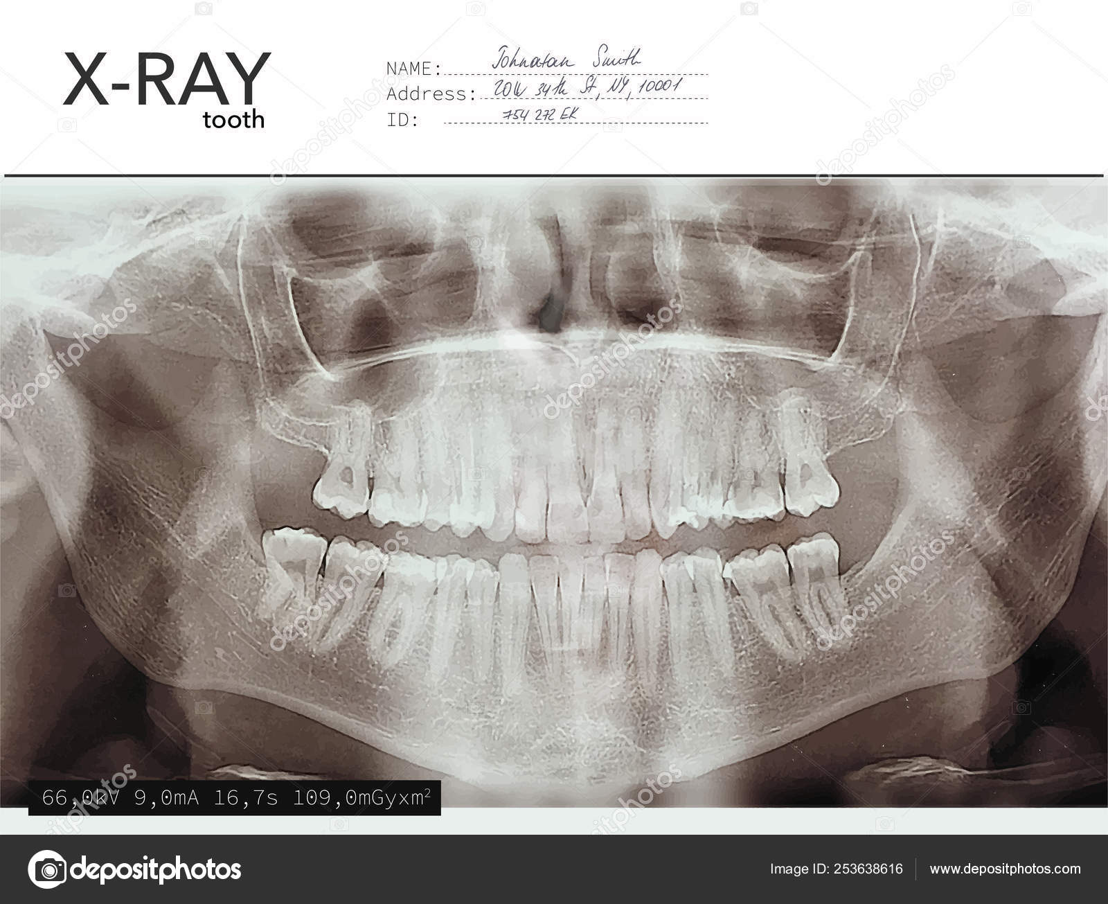 Xray Teeth Mouth Dental Tomography Vector X Ray Radiology Oral Panorama Medical Skeleton X Ray Background Vector Image By C Chiken Brave Vector Stock 253638616