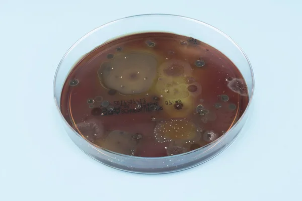 Μικρόβια Που Αναπτύσσονται Στο Πιάτο Αγάρ Μπλε Φόντο — Φωτογραφία Αρχείου