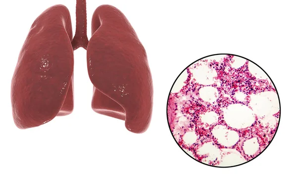 Illustrazione Digitale Dell Anatomia Dei Polmoni Umani Micrografo Leggero Sezione — Foto Stock