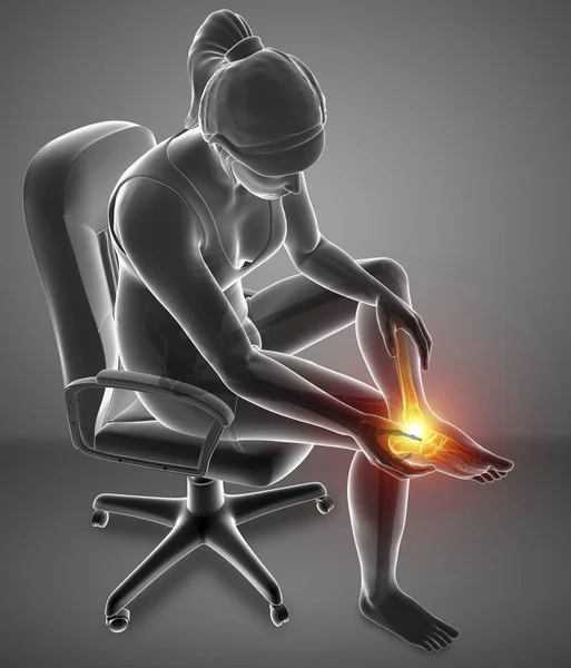 Sitting Chair Female Silhouette Foot Pain Digital Illustration — Stock Photo, Image