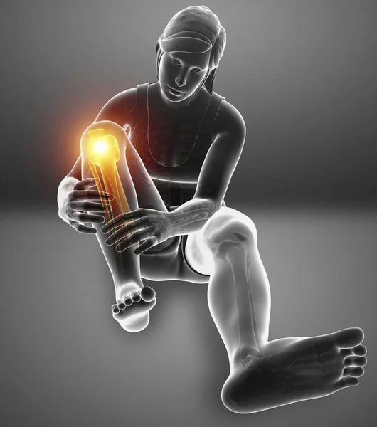 Sitting Female Silhouette Knee Pain Digital Illustration — Stock Photo, Image
