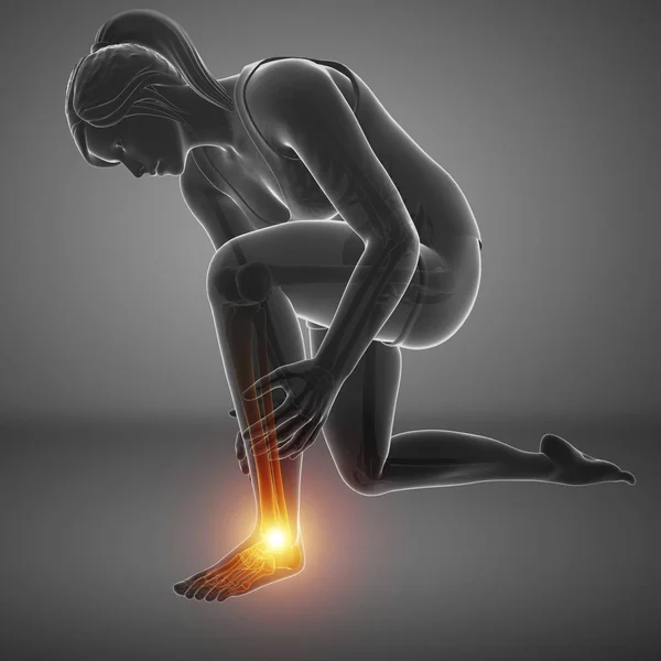 足の痛み デジタル イラストとシルエットが女性を曲げ — ストック写真