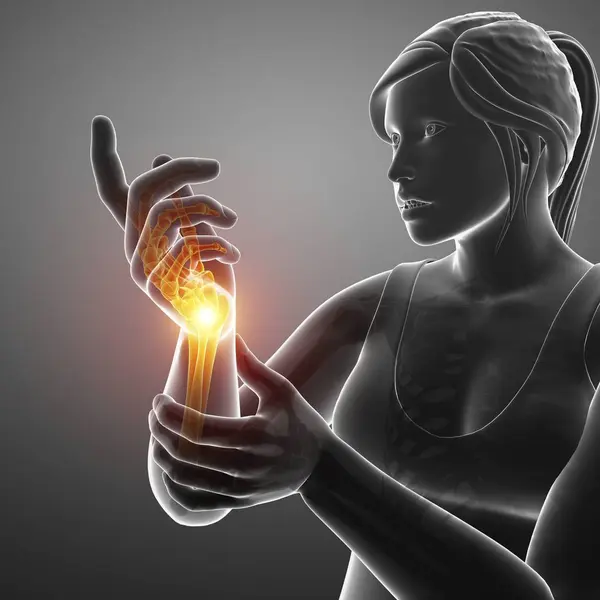 Female Silhouette Wrist Pain Digital Illustration — Stock Photo, Image