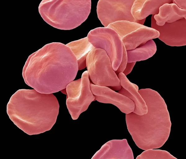 Färgade Scanning Electron Mikrograf Röda Blodkroppar — Stockfoto
