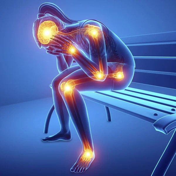 Sitting Bench Female Silhouette Joint Pain Digital Illustration — Stock Photo, Image