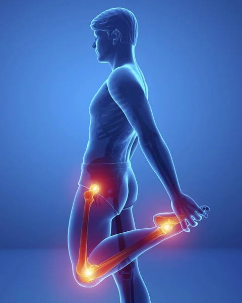 Male Silhouette Knee Pain Digital Illustration — Stock Photo, Image