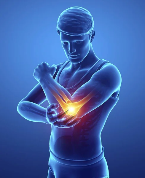 Male Silhouette Elbow Pain Digital Illustration — Stock Photo, Image