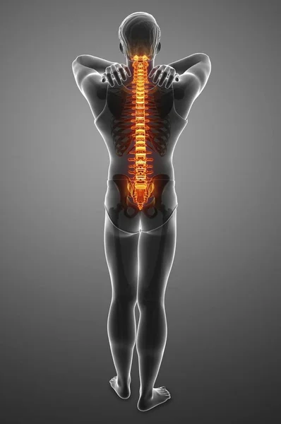 Male Silhouette Back Pain Digital Illustration — Stock Photo, Image