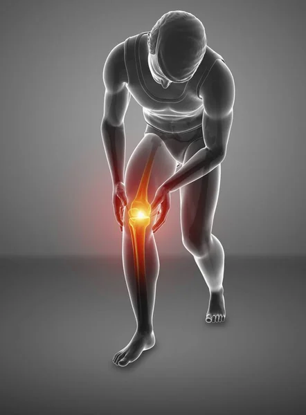 Bending Male Silhouette Knee Pain Digital Illustration — Stock Photo, Image