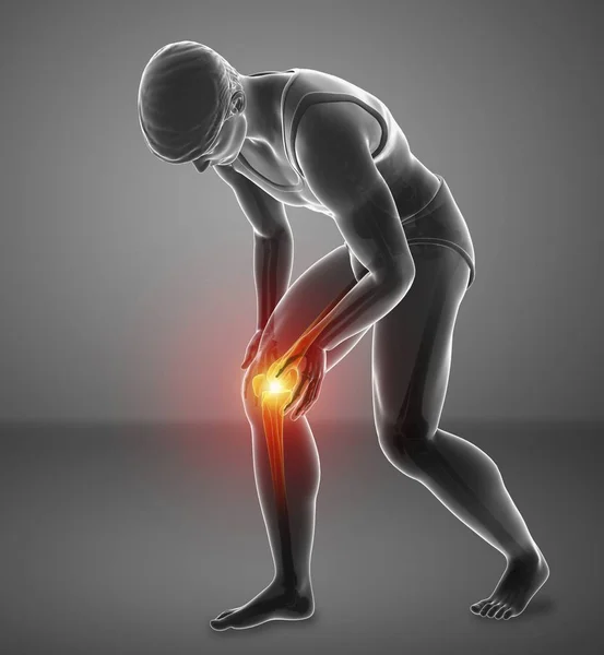 Bending Male Silhouette Knee Pain Digital Illustration — Stock Photo, Image