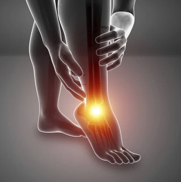 Male Feet Silhouette Foot Pain Digital Illustration — Stock Photo, Image