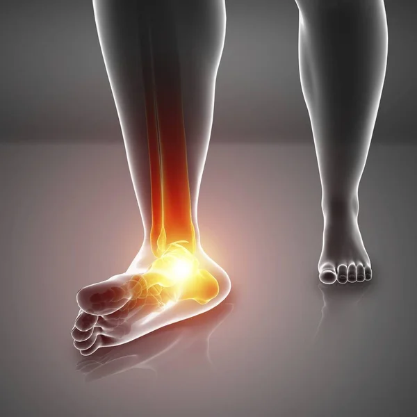 Male Feet Silhouette Foot Pain Digital Illustration — Stock Photo, Image