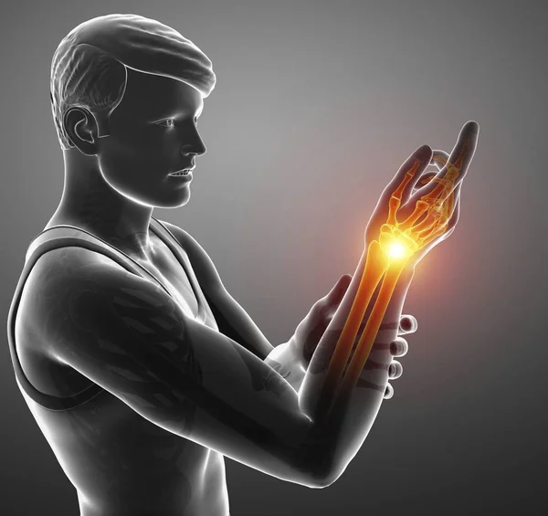 Male Silhouette Wrist Pain Digital Illustration — Stock Photo, Image