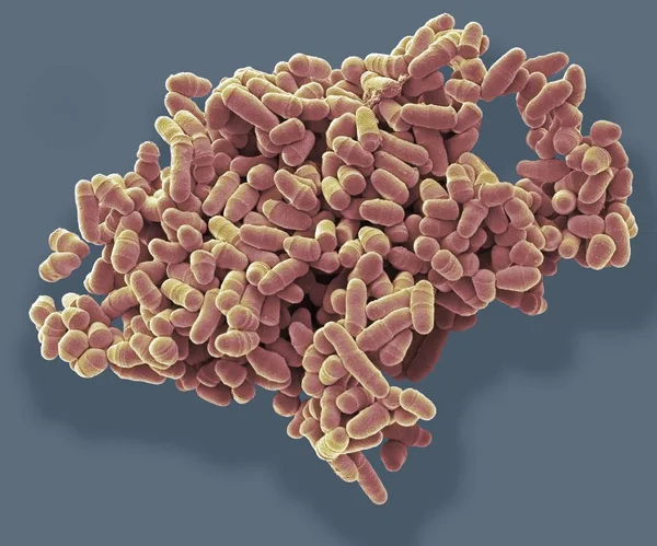 Micrographie Électronique Balayage Coloré Cellules Levure Schizosaccharomyces Pombe Division — Photo