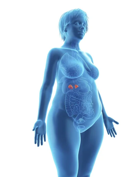 Illustration Silhouette Bleue Une Femme Obèse Avec Des Glandes Surrénales — Photo
