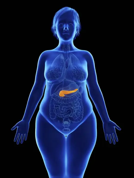 Illustrazione Frontale Silhouette Blu Donna Obesa Con Pancreas Evidenziato Sfondo — Foto Stock