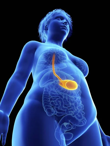 低角度图插图在肥胖妇女的剪影的黑色与突出的胃 — 图库照片