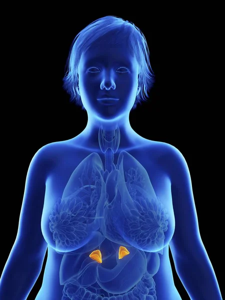 Illustration Black Silhouette Obese Woman Highlighted Adrenal Glands — Stock Photo, Image