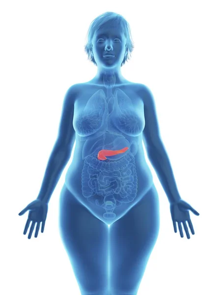 Illustrazione Della Silhouette Blu Della Donna Obesa Con Pancreas Evidenziato — Foto Stock