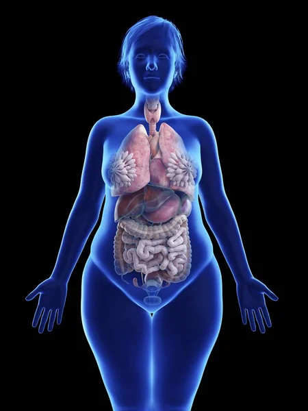 例证在肥胖妇女的剪影的黑色与突出的内脏器官 — 图库照片