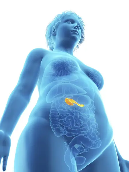 Low Angle View Illustration Blue Silhouette Obese Woman Highlighted Pancreas — Stock Photo, Image