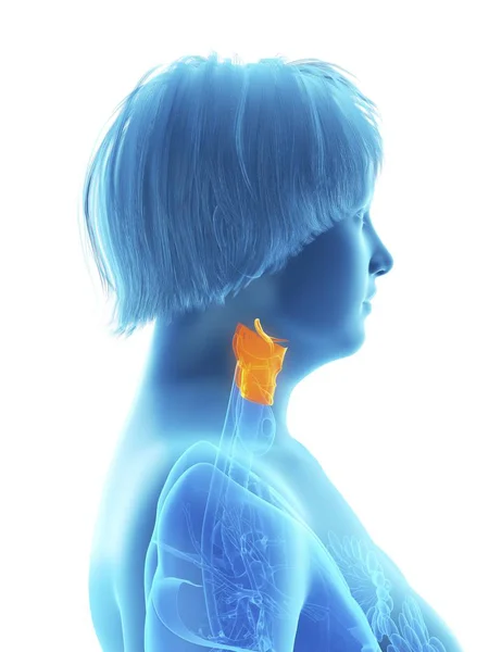 Side View Illustration Blue Silhouette Obese Woman Highlighted Larynx — Stock Photo, Image