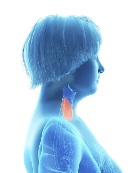 強調表示されている甲状腺を持つ Obese 女性の青いシルエットの側面図 — ストック写真