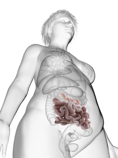 肥胖妇女剪影的低角度图例证与突出的小肠 — 图库照片