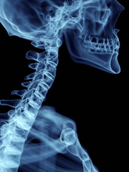 Ilustração Close Silhueta Azul Transparente Esqueleto Com Coluna Cervical Colorida — Fotografia de Stock