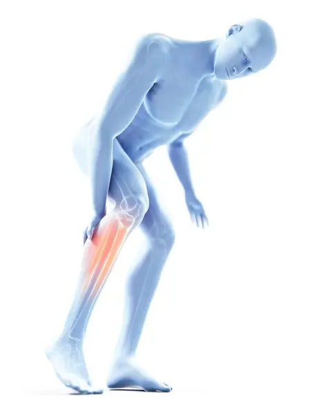 Rendered Illustration Blue Silhouette Man Painful Calf — Stock Photo, Image