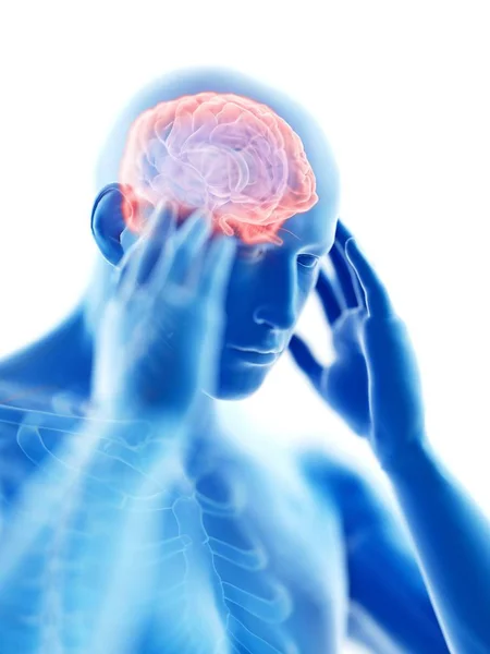 Wytopione Ilustracja Niebieski Sylwetka Człowieka Bólem Głowy Białym Tle — Zdjęcie stockowe