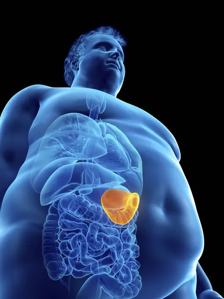 Illustration Silhouette Obese Man Visible Spleen — Stock Photo, Image