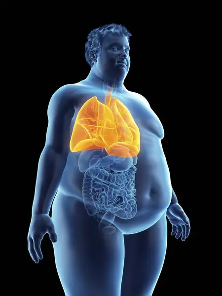 Sziluettje Látható Tüdő Elhízott Ember Illusztrációja — Stock Fotó
