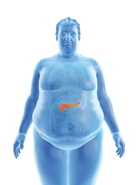 Illustrazione Della Silhouette Dell Uomo Obeso Con Pancreas Visibile — Foto Stock