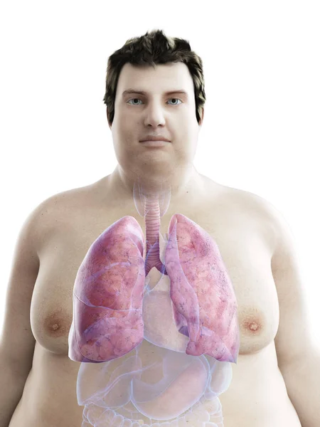 Illustration Figure Obese Man Visible Lungs — Stock Photo, Image