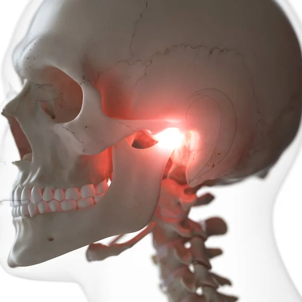 Digitale Illustration Schmerzhafter Kiefergelenke Menschlichen Skelett — Stockfoto