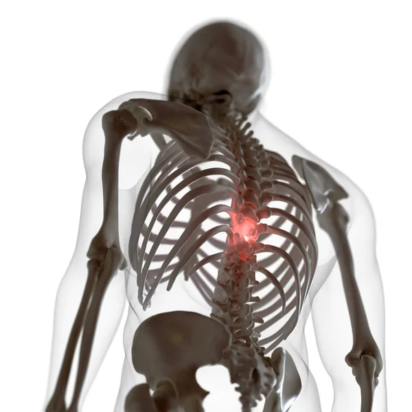 Ilustração Digital Costas Dolorosas Esqueleto Humano — Fotografia de Stock
