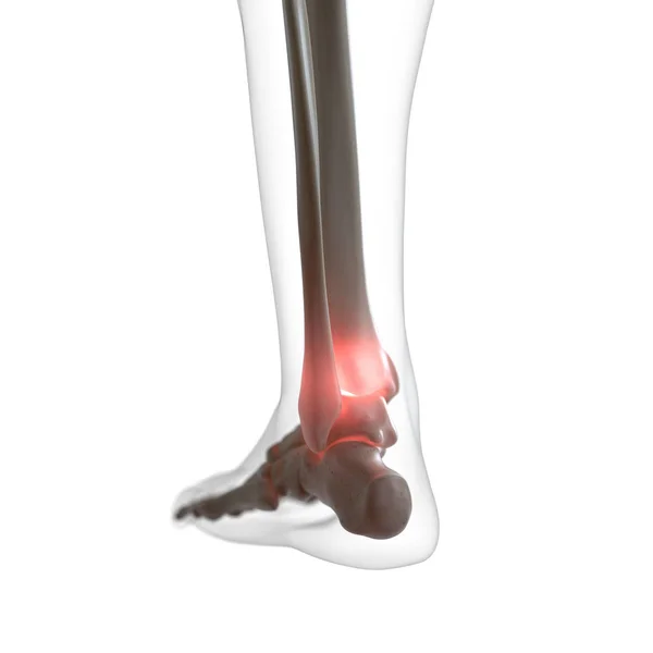 Digital Illustration Painful Ankle Human Skeleton — Stock Photo, Image