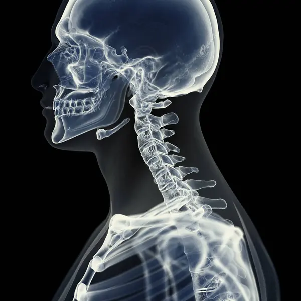 Illustration Der Halswirbelsäule Menschlichen Skelett — Stockfoto