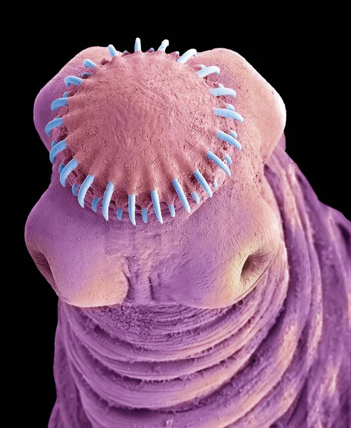 Scanarea Micrografului Electronic Capului Tapeworm Porc Parazit Intestinal — Fotografie, imagine de stoc