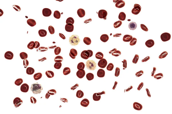 Dijital Illüstrasyon Kırmızı Kan Hücreleri Trombosit Nötrofiller Monosit Lenfositler Normal — Stok fotoğraf