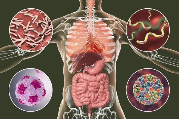 Digitale Illustration Mit Bakterien Die Infektionen Der Atemwege Und Des — Stockfoto