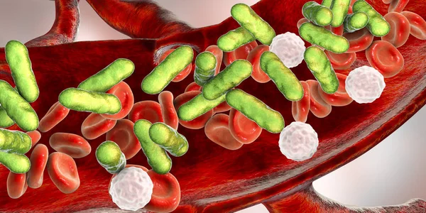 細菌性血液感染症 デジタルイラスト — ストック写真