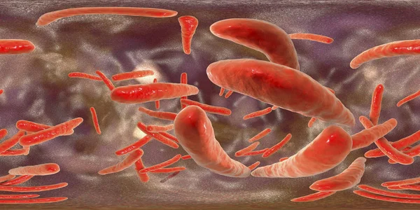 Illustration Numérique Bactérie Mycobacterium Tuberculosis Gram Positive Forme Tige Qui — Photo