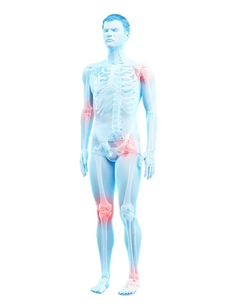 Human Body Points Joint Pain Conceptual Illustration — Stock Photo, Image