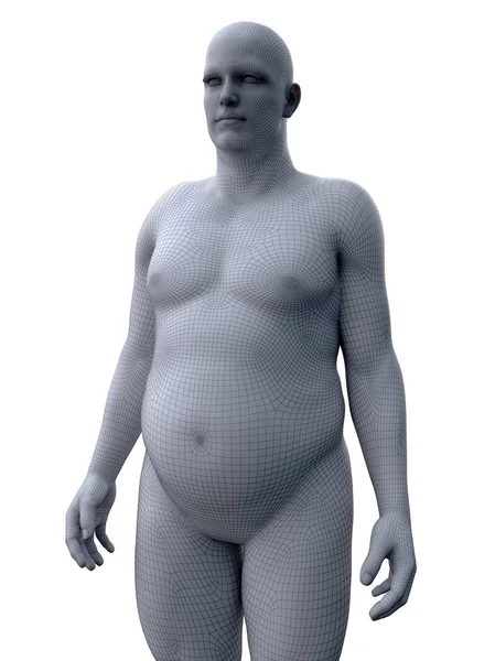 Grijs Anatomisch Model Van Zwaarlijvige Man Digitale Illustratie — Stockfoto