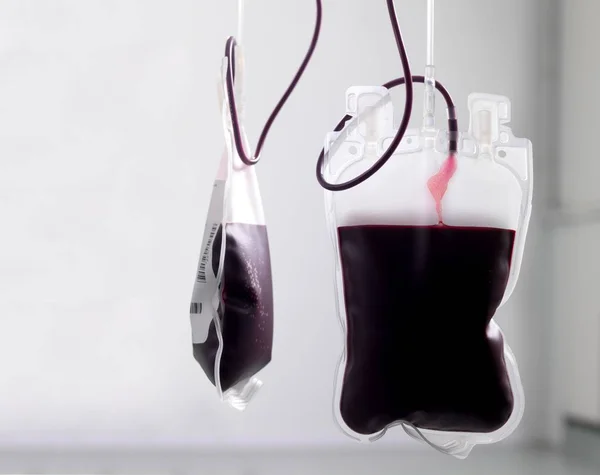 Donor Blood Being Separated Component Parts Bags — Stock Photo, Image
