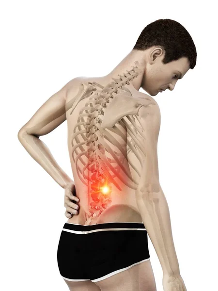 Männliche Silhouette Mit Rückenschmerzen Auf Weißem Hintergrund Konzeptionelle Illustration — Stockfoto